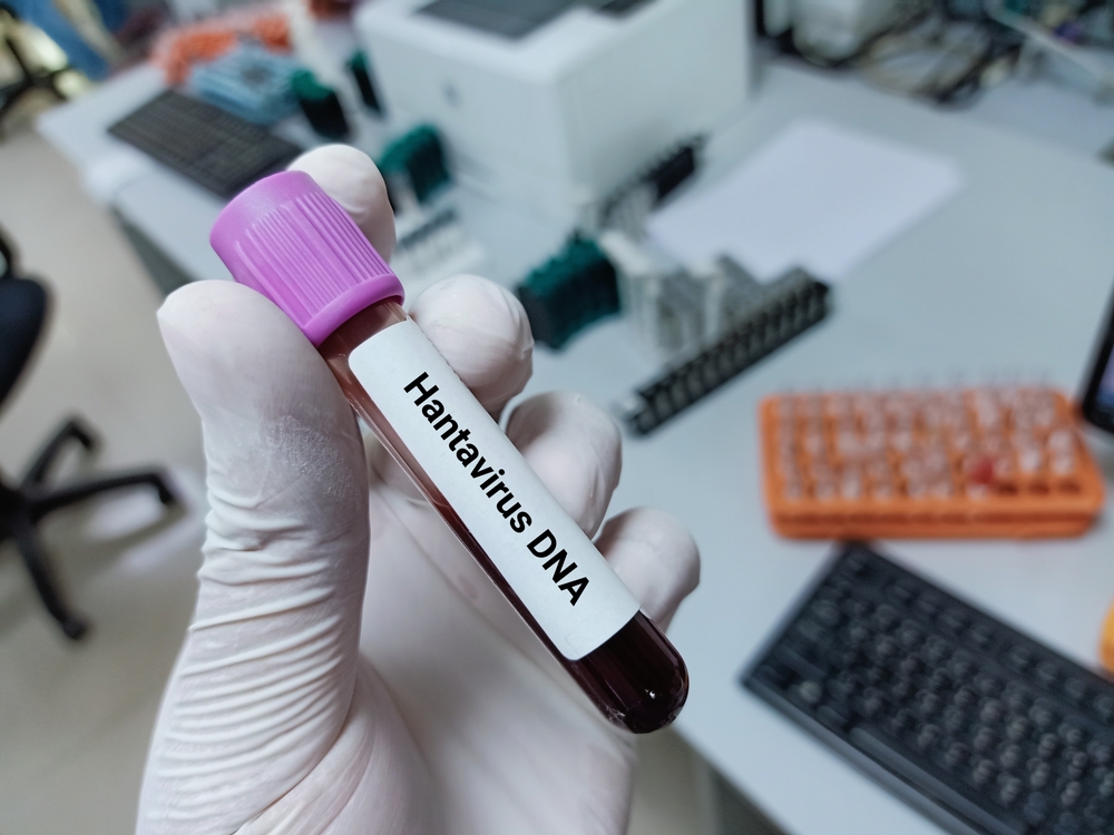 hantavirus